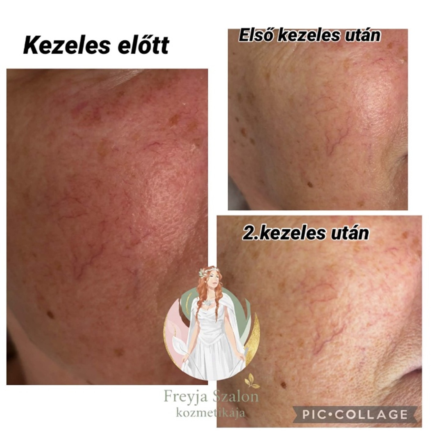 kezeles_1